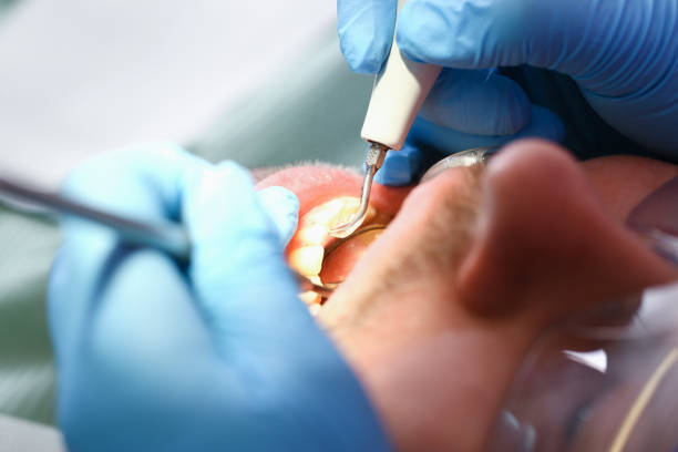 Best After-Hours Emergency Dentist in Granite Shoals, TX