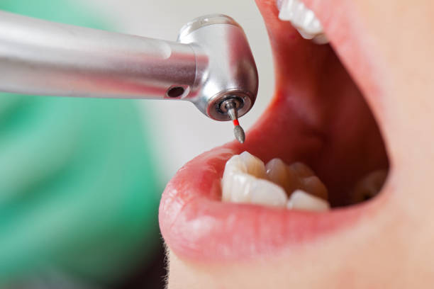 Best Pediatric Emergency Dentist in Granite Shoals, TX